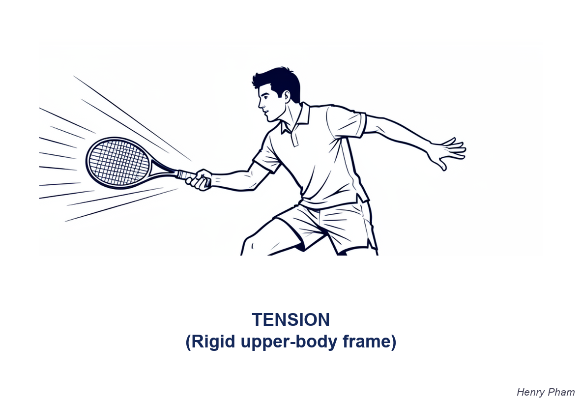 Mốc 1 — TENSION