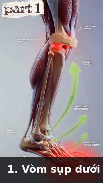 L4-L5 disc anatomy