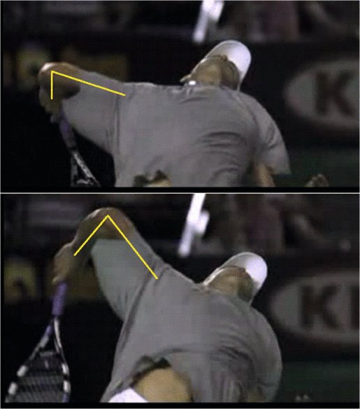 Phân tích chuỗi động học dạng roi da và phản xạ căng cơ trong cú giao bóng của Roddick và Federer