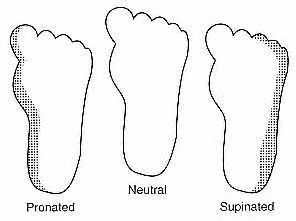 Ba dạng bàn chân — sấp (pronated), trung tính và ngửa (supinated) — quyết định tư thế đứng và bộ chân.